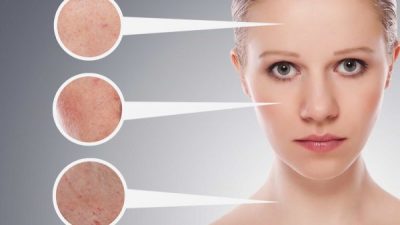 پیلینگ آنزیمی دکتر پن بیوتی