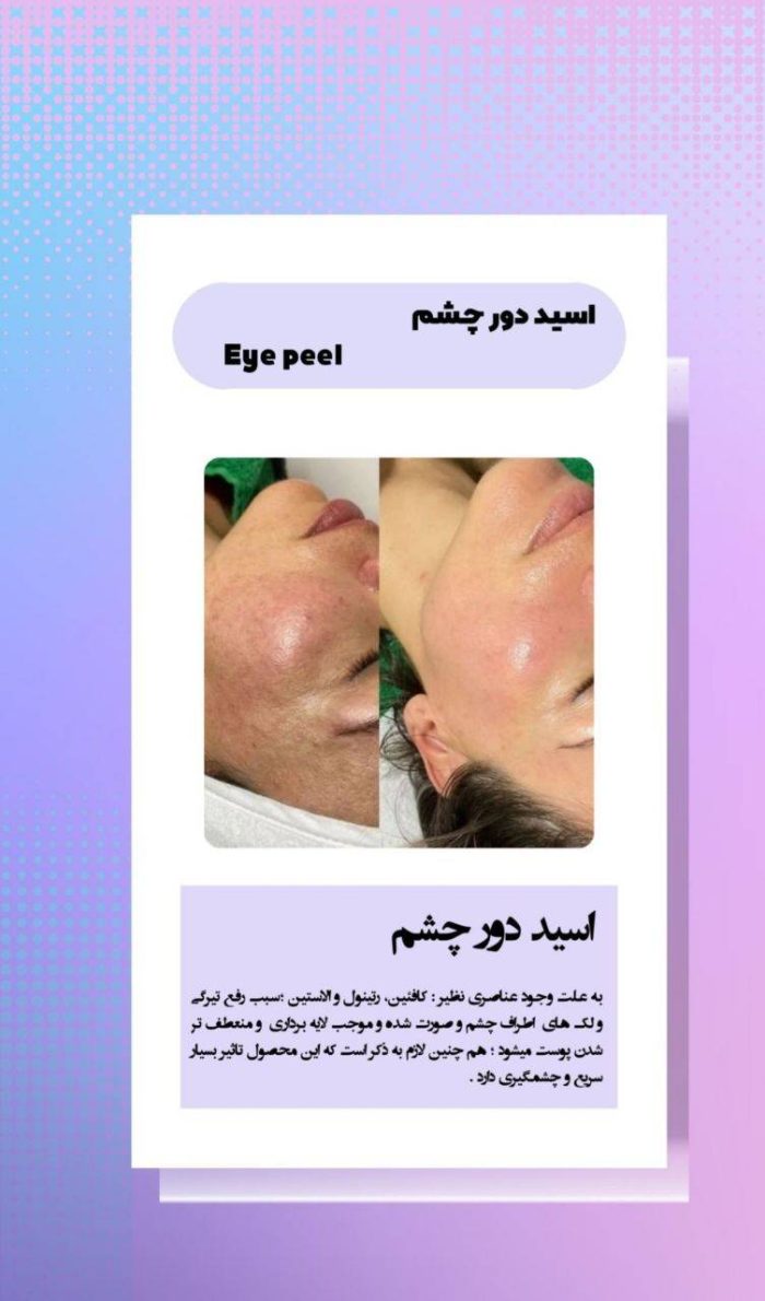 سرم روشن کننده دور چشم اسکین تایم کره جنوبی 30 میلی لیتر