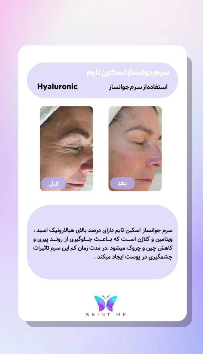 سرم جوانساز اسکین تایم کره جنوبی