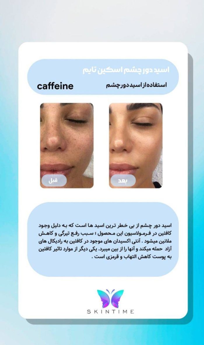سرم روشن کننده دور چشم اسکین تایم کره جنوبی 30 میلی لیتر